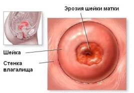 Травмы женских половых органов во время секса | Лечение и консультация в СПб